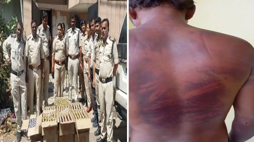 युवक के बदन पर पुलिस की बर्बरता के निशान